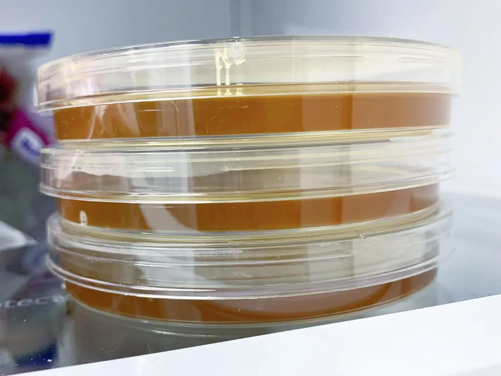 Petri dishes in fridge